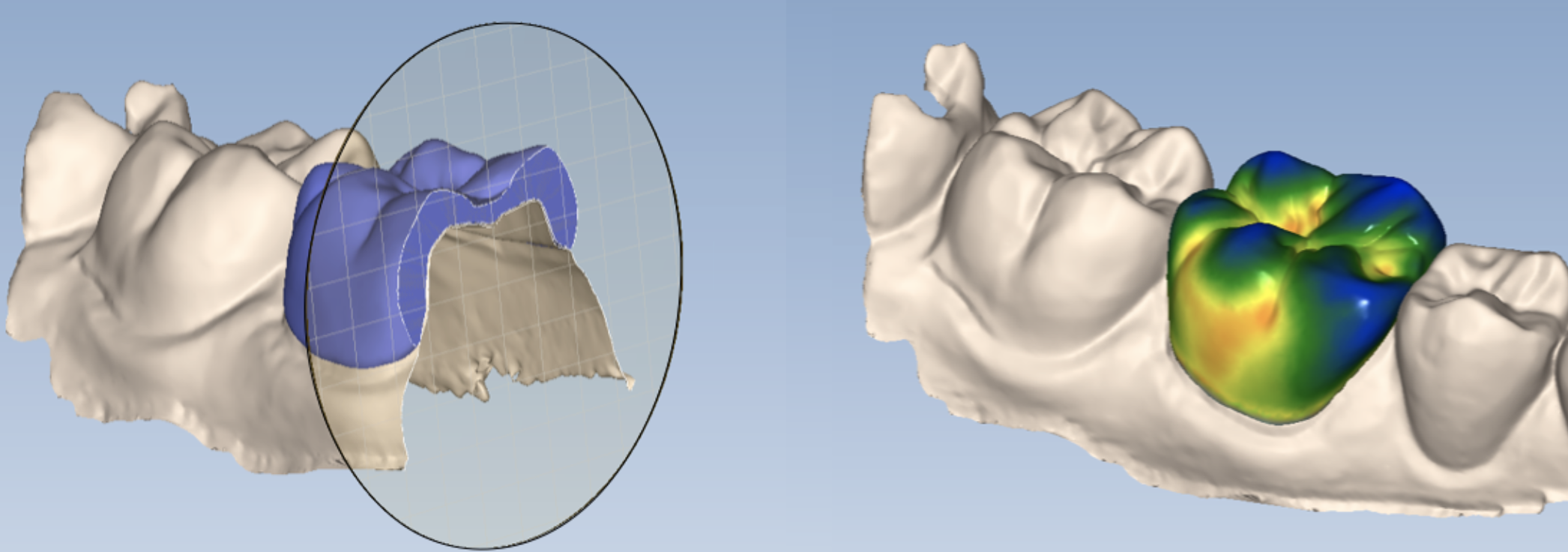 Biomaterials and Digital Dentistry Lab Stony Brook University School of Dental Medicine